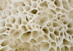 válečkovka keříčkovitá v. síťovitá (Ceratiomyxa fruticulosa var. porioides)